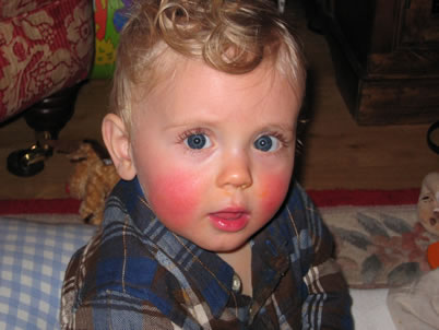 Red Cheeks Photo